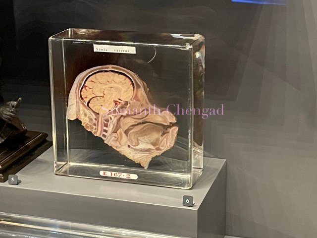 Cross-section of Orangutan head