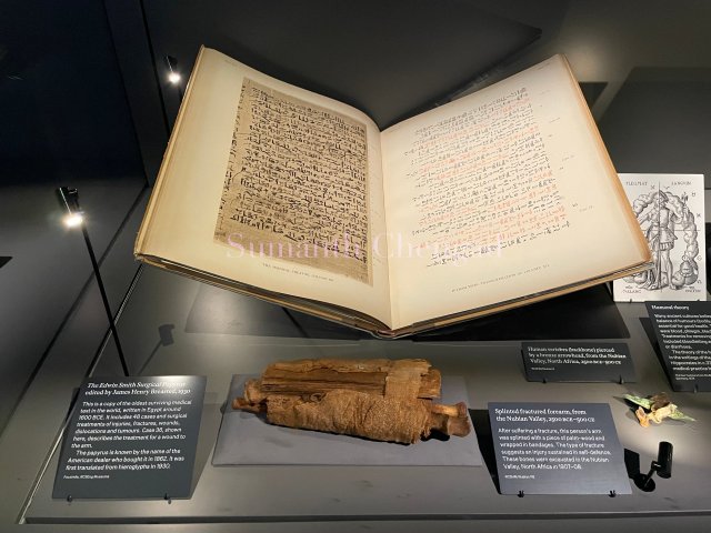 Display at Hunterian Museum