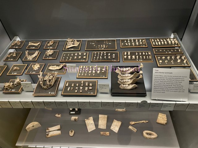 Collection of teeth