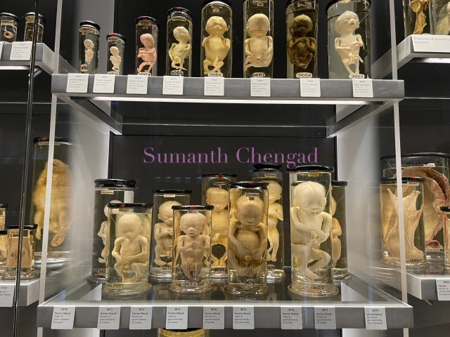 Human fetuses