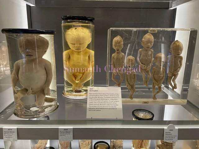 Human fetuses